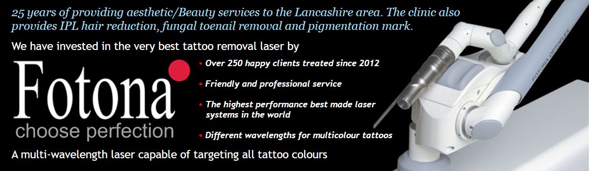 laser tattoo removal at Prestons top beauty salon