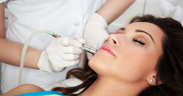 microdermabrasion facial treatments