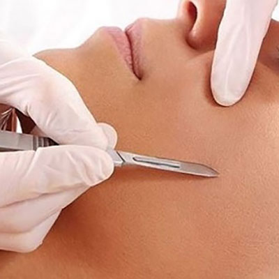 Achieve A Radiant Complexion With Dermaplaning