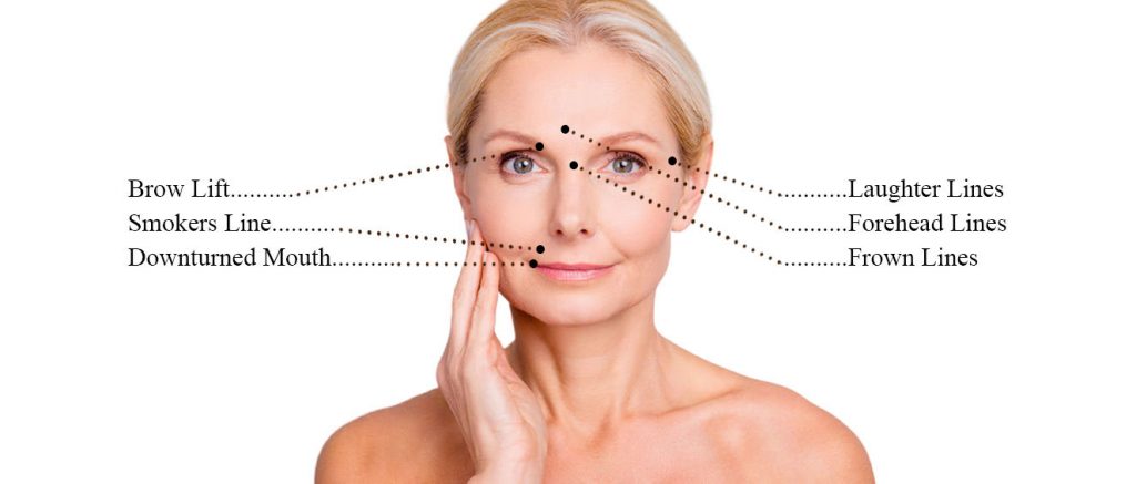 anti wrinkle injections at Be Beautiful Salon in Fulwood, Preston