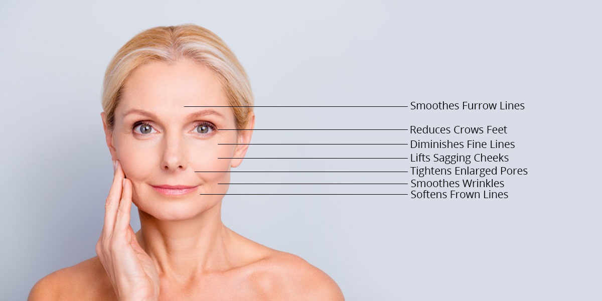 microneedling at Be Beautiful Hair Beauty Salon in Preston