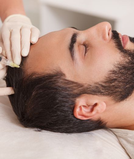 HAIR FILLER AT BE BEAUTIFUL SALON IN FULWOOD, PRESTON