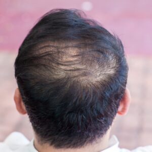 Hair repair treatments Preston