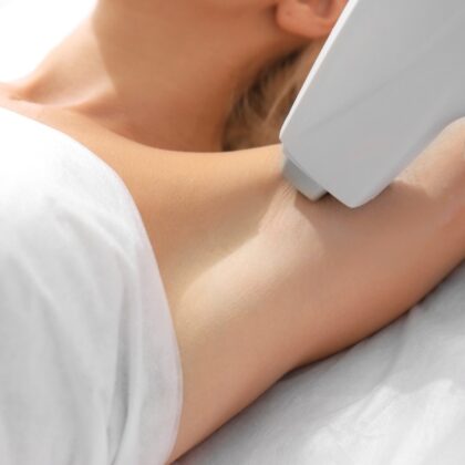 Permanent hair reduction in Preston