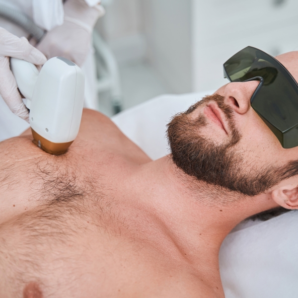 Laser hair removal for men Preston