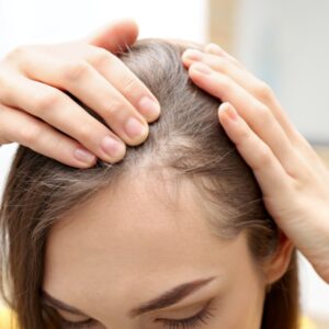 Strengthen damaged hair Preston