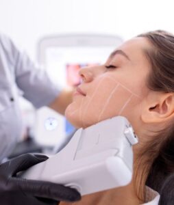 HIFU ultrasound facial treatment at Be Beautiful Preston clinic