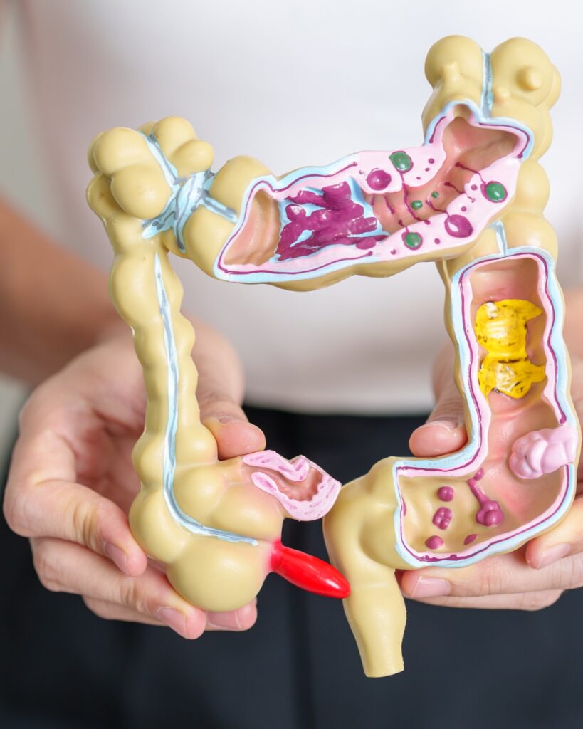 Colonic Hydrotherapy Support Preston Colonic Hydrotherapy Support Preston